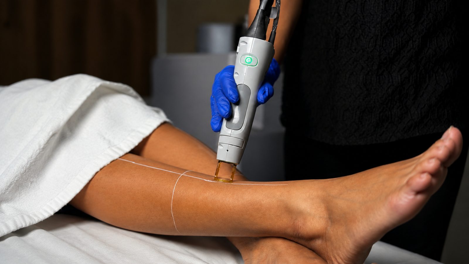 Laser hair removal on the lower leg